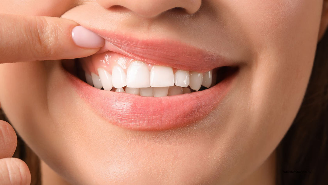 Whitening Strips vs Whitening Serum: Which One is Better?